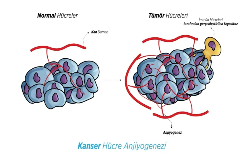 Kanser Tedavisi: Öğretmen Hacı Karaalp Hayatını Kaybetti